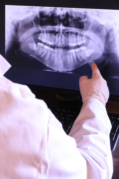 Best Emergency Root Canal Treatment in Binghamton University, NY