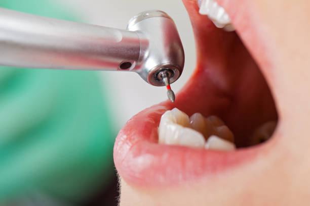 Best Emergency Treatment for Toothache in Binghamton University, NY